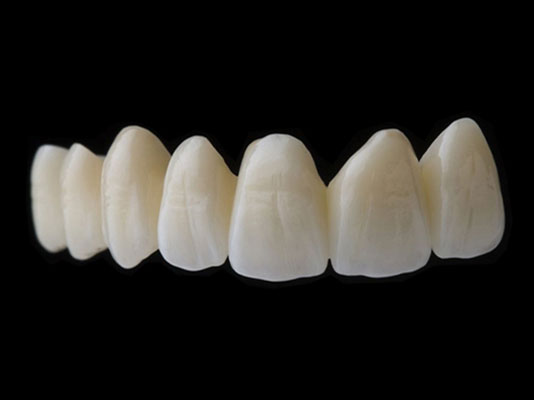 Multi-layer Full Zirconia