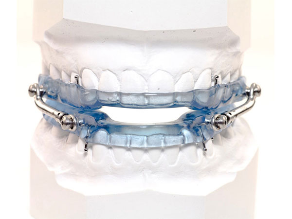 Dental Appliance