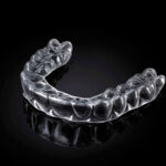 Clear Aligner