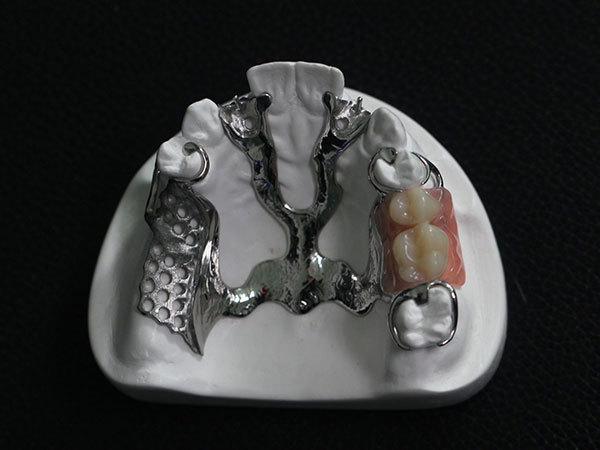 Dental Framework