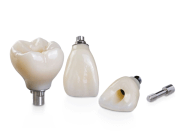 Implant Crown & Bridge