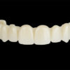 Acrylic Temporary Teeth