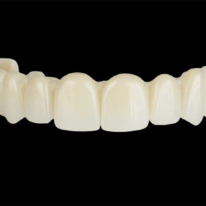 Acrylic Temporary Teeth
