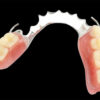 Acrylic Temporary Teeth