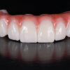 Acrylic Temporary Teeth