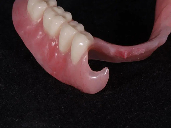 Acrylic Temporary denture