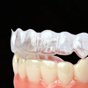 Clear Aligner