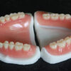 Full Acrylic Denture