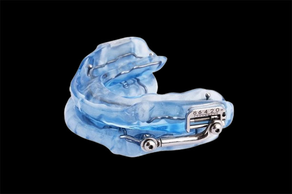 Herbst Oral Appliance