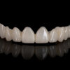 PMMA Temporary Teeth