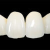 PMMA denture