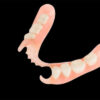 Partial Acrylic Denture