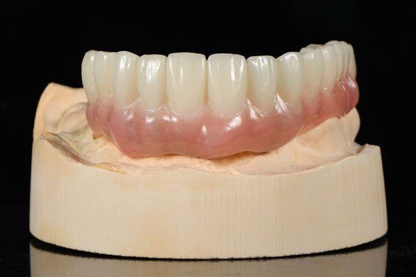 Temporary Teeth