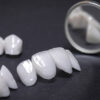 Zirconia Veneers