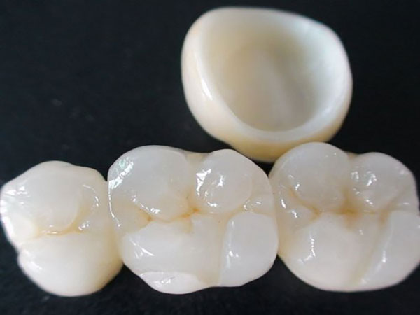 zirconia crown