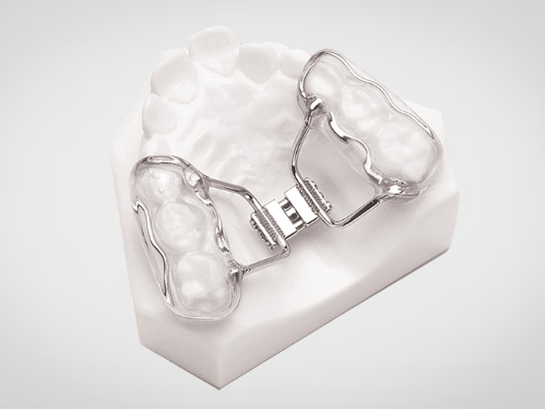 Bonded Palatal Expander