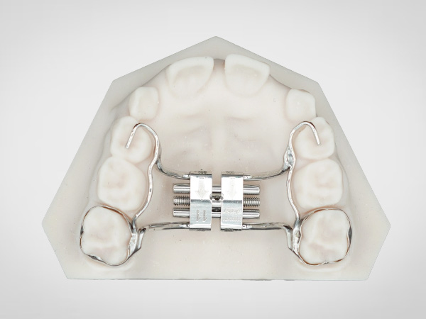 Hyrax Rapid Palatal Expander