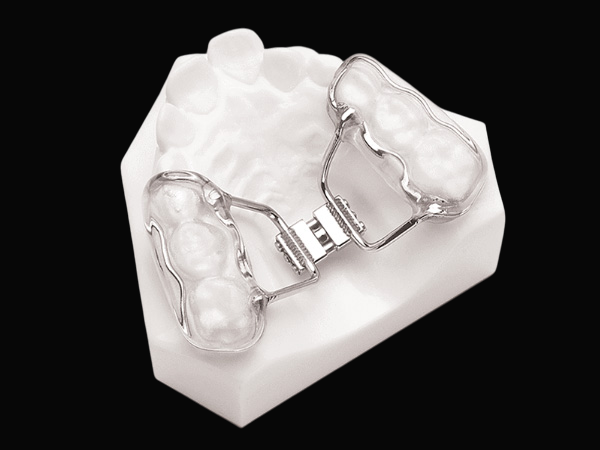 Bonded Palatal Expander
