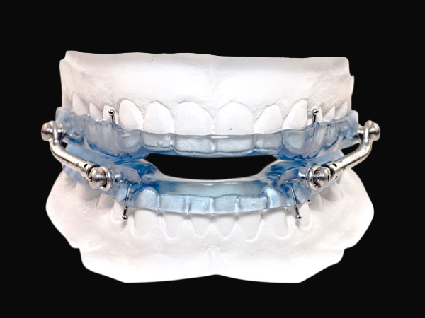 Dental Appliance