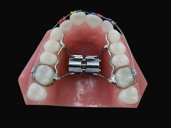 Dental Expander
