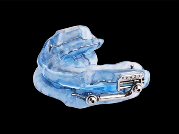 Herbst Oral Appliance