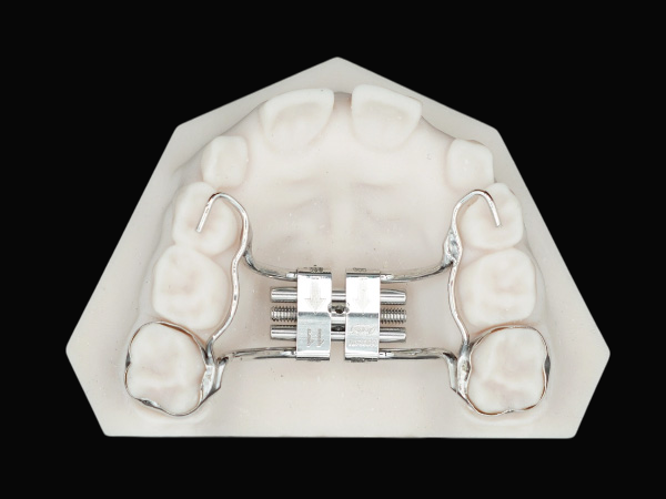 Hyrax Rapid Palatal Expander
