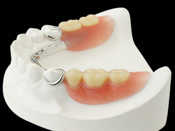 Partial Acrylic Denture