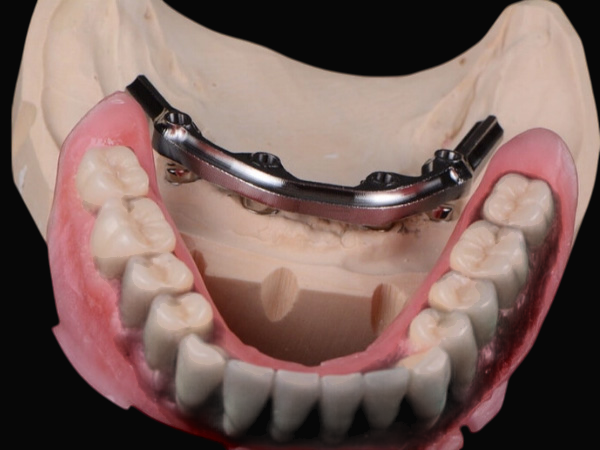 Stud snap Attachment