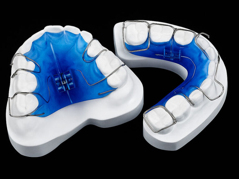 Orthodontic expander