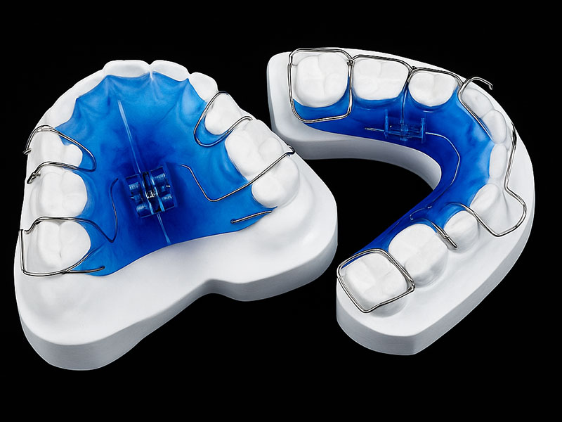 Spf Expander Palatal Expander | Dental Expander Lab | Bestodental