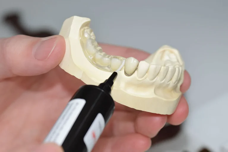 PFM Restoration Repair