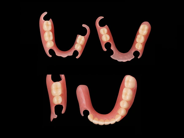 Partial Design Options