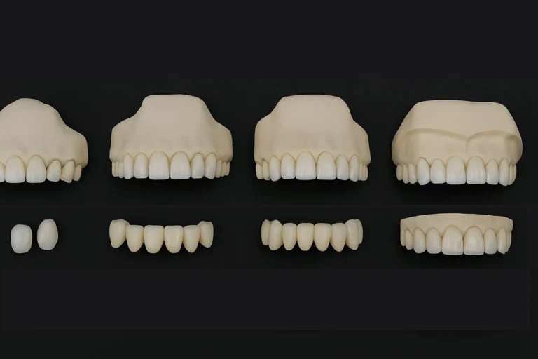 Veneer Quantity Options