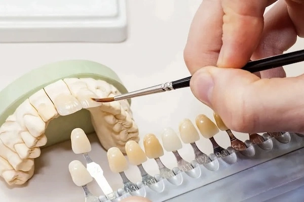 Digital Dental labs in California
