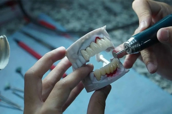 Dental labs in Malaysia
