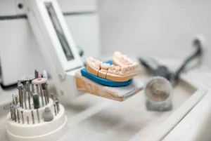 Dental labs in Singapore