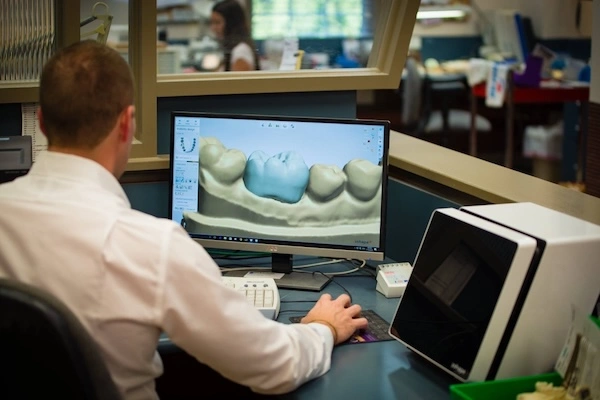 Veneer Labs in Europe