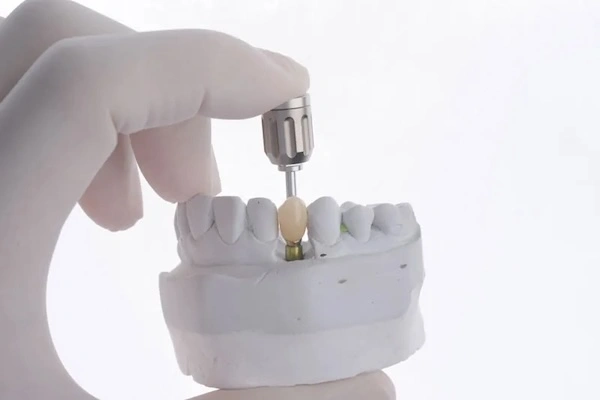 Dental Implant Companies in India