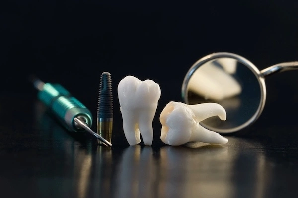 Dental Implant Companies in the World