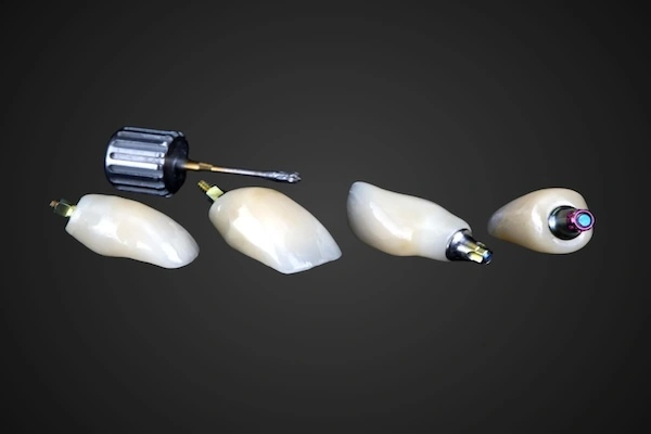 Dental Implant Labs in China