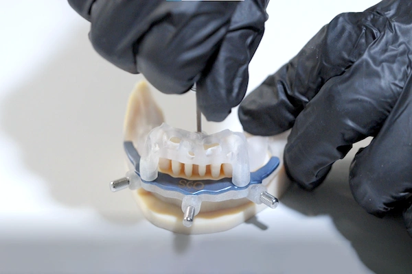 Temporary Restoration Labs in the World