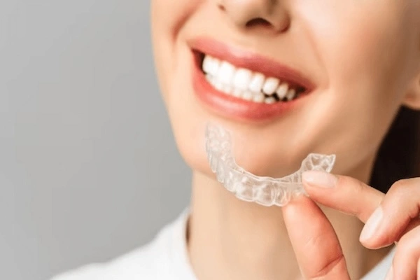 Aligner Companies in India