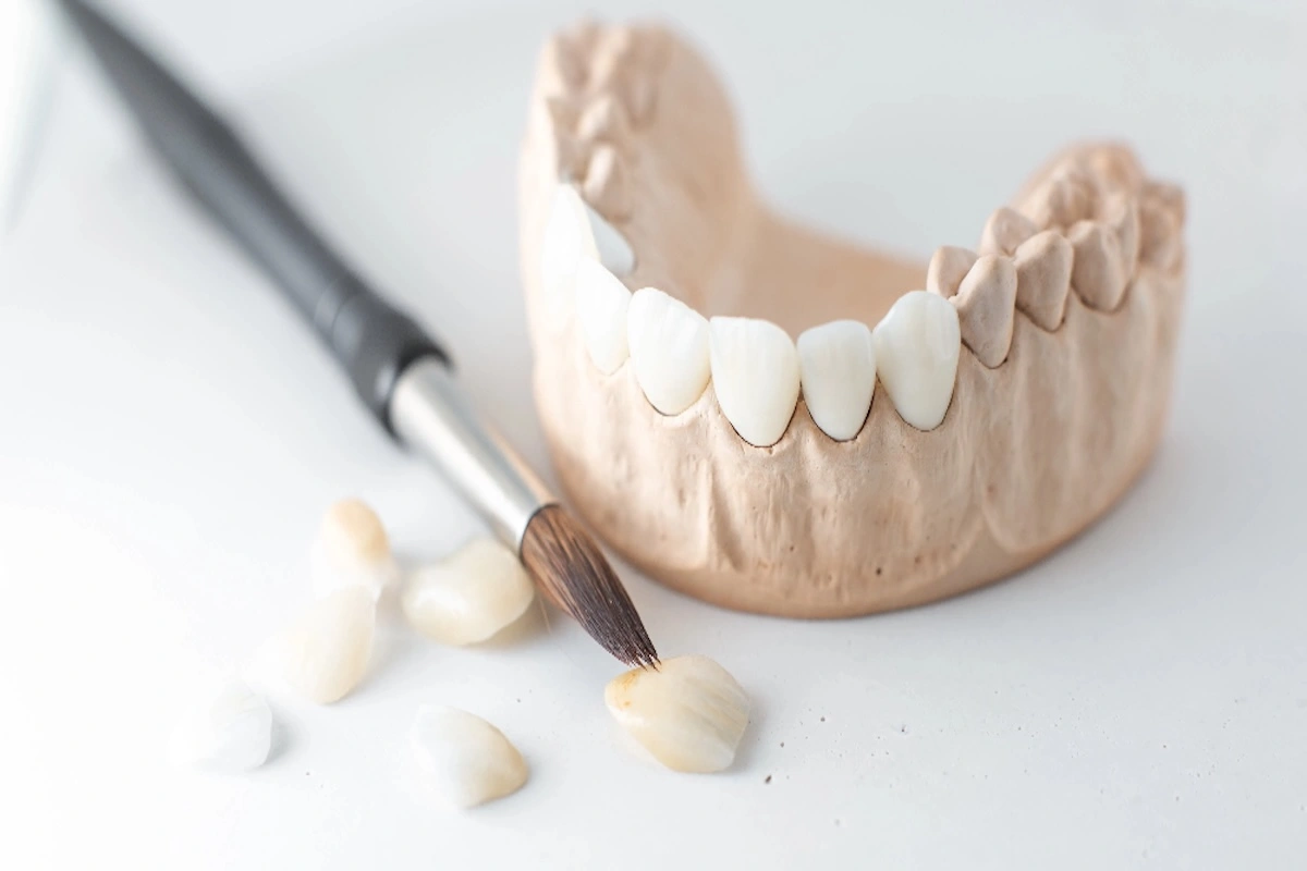 Dental Zirconia