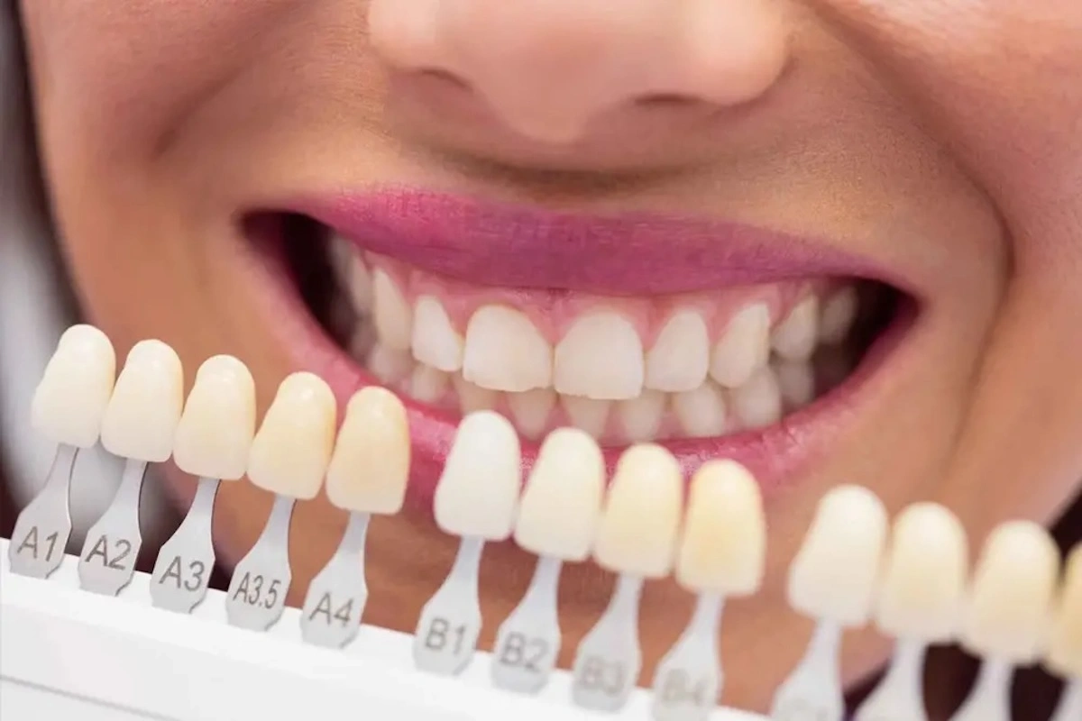 E.max Outsourcing Guide