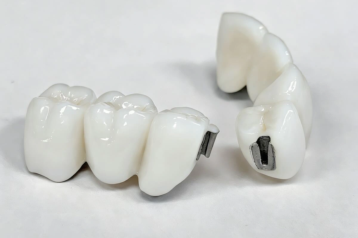 Precision Dental Attachment Outsourcing