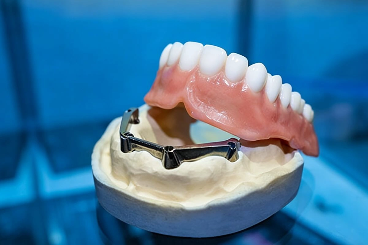 Dental Framework Outsourcing