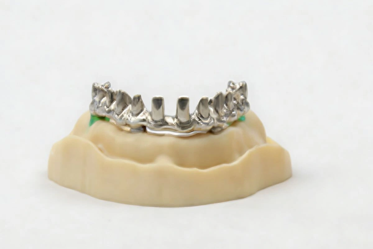 Telescopic Restoration Outsourcing