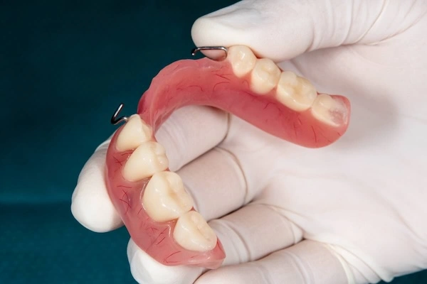 Acrylic Denture Outsourcing