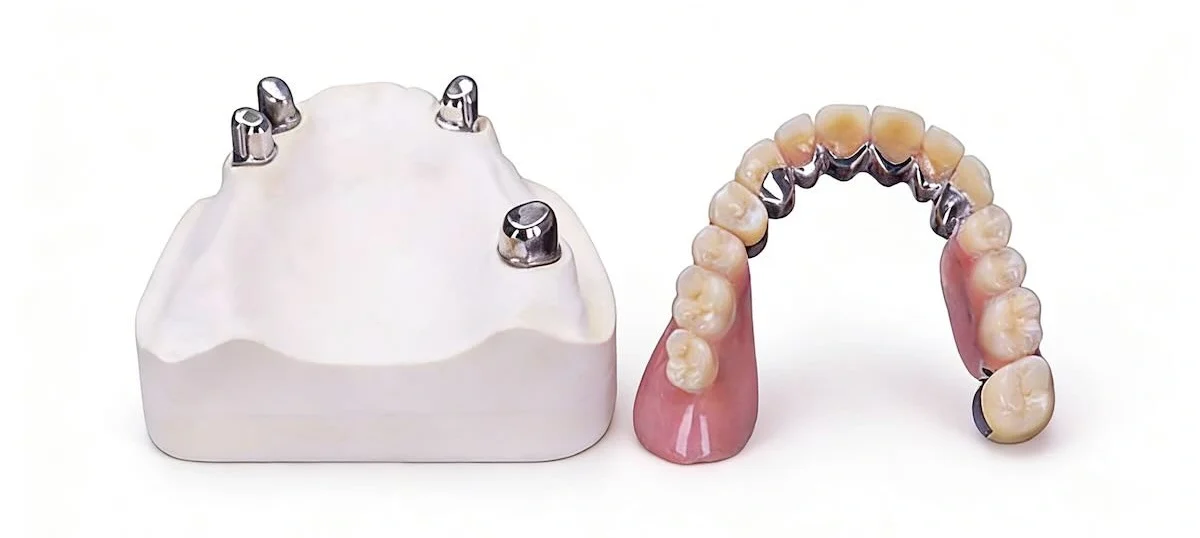 Telescopic Restoration Outsourcing