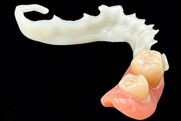 Dental Framework Outsourcing